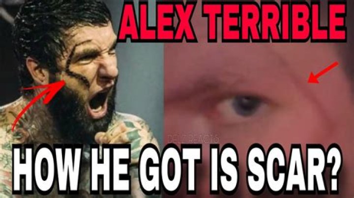 Alex Terrible's Face Scar And The Untold Story