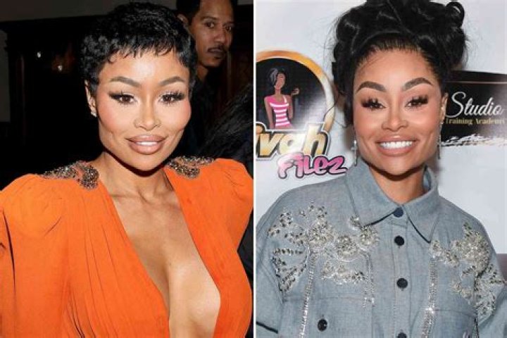Blac Chyna's Journey Before Surgery