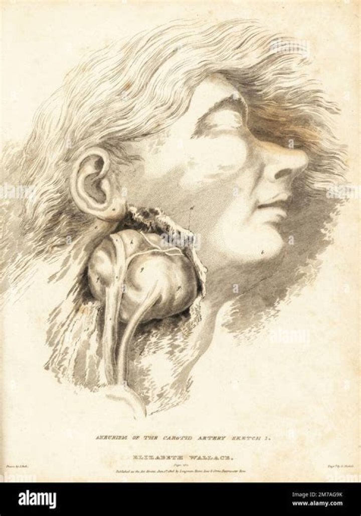 Discoveries From Dr. Butcher Brown's Surgery Pictures