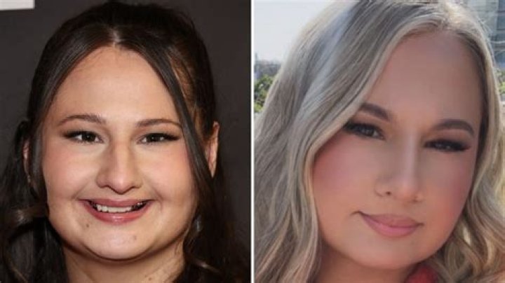 Gypsy Rose Blanchard Nose Job: The Truth Behind the Transformation