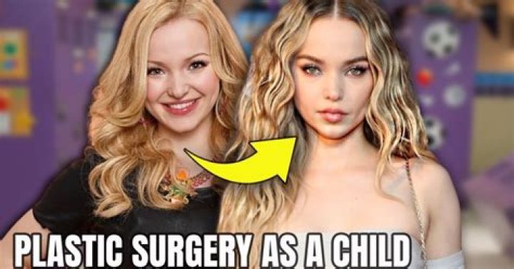 Has She Had Plastic Surgery?