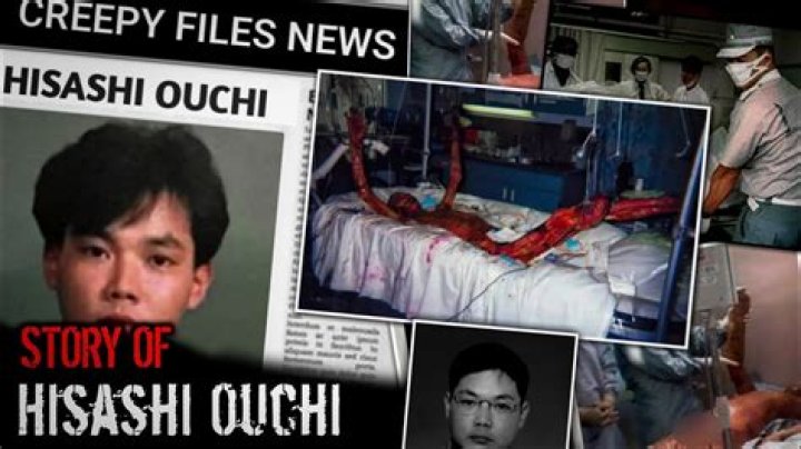 Hisashi Ouchi Photos Real: A Deep Dive into the Life and Legacy of a Tragic Incident