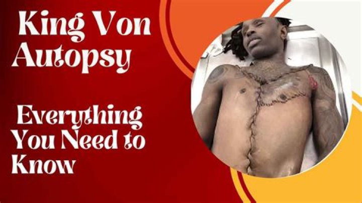 King Von's Autopsy Reveals Startling Truths