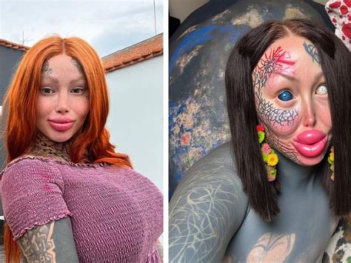 Mary Magdalene Model Before and After Surgery: Meet Her On Instagram