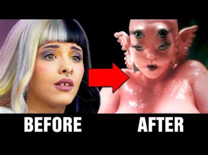 Melanie Martinez After Plastic Surgery: Unraveling The Truth