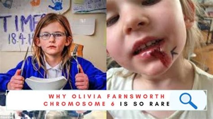 Olivia Farnsworth Wikipedia : Everything To Know About The Girl With A Rare Chromosome 6 Deletion