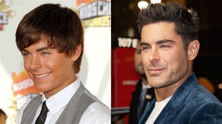 Uncover The Secrets Behind Zac Efron's New Face