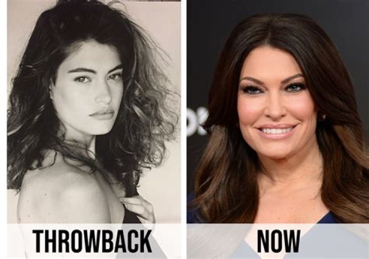 Uncover The Secrets Of Kimberly Guilfoyle's Plastic Surgery Journey