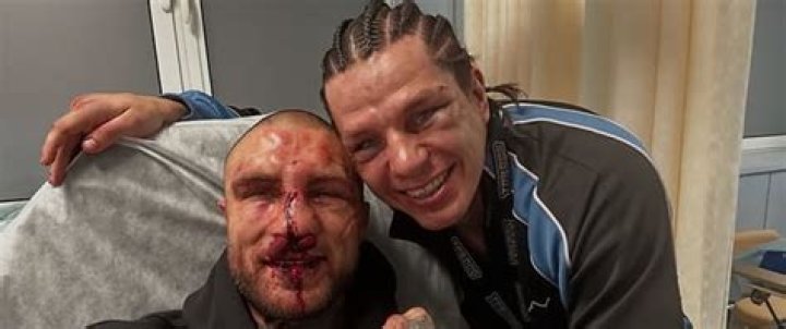 Unveiling The Depths Of Alex's Terrible Face Wound